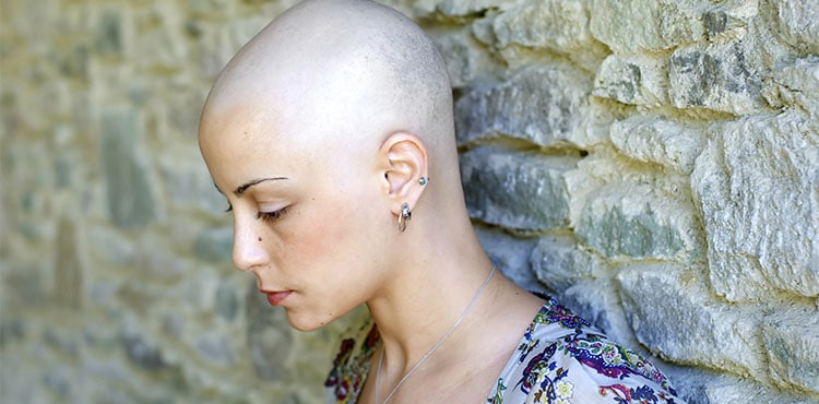 Bald Woman - Indiana Taxotere Hair Loss Lawsuit