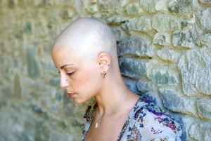 A Bald Woman | Michigan Taxotere Hair Loss Lawsuit