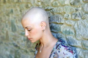 Woman Looking Down | Missouri Taxotere Hair Loss Lawsuit