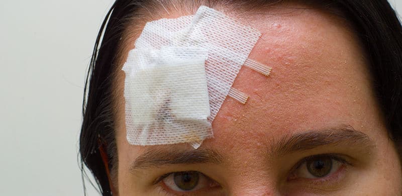 Student with Bandaged Head | Ohio Brain Injury Lawyer
