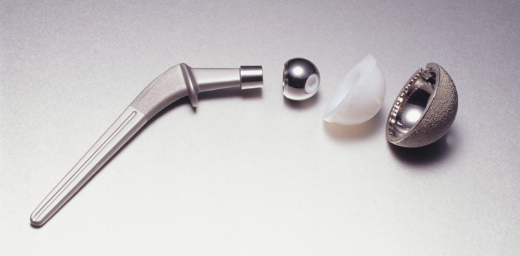 Metal hip components | Biomet Hip Replacement Attorneys