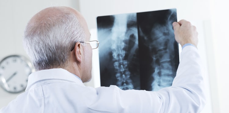 Doctor looking at x-ray | INFUSE Bone Graft Lawsuit