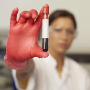 Woman with Vial of Blood | Alere INRatio Lawsuit