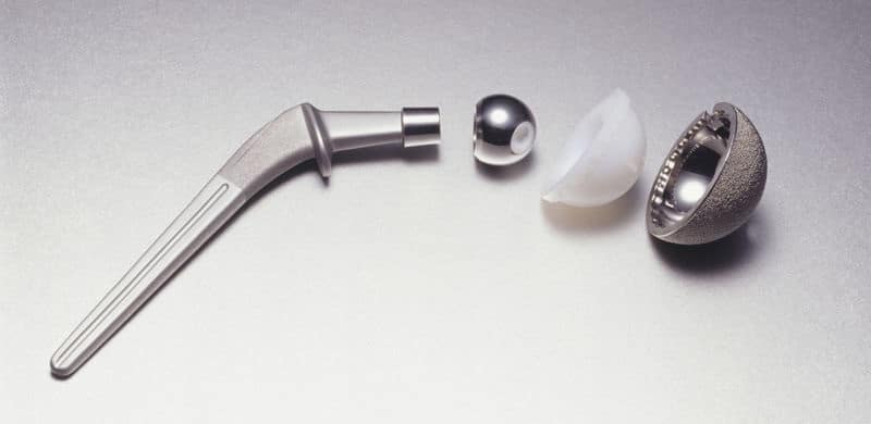 Stryker Hip Replacement Lawsuit
