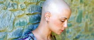 A Bald Woman | Florida Taxotere Hair Loss Lawsuit