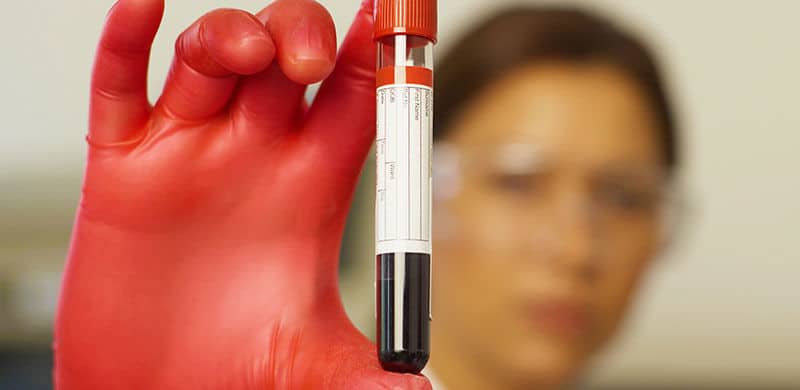 Image Of A Vial Of Blood | Louisiana Actos Lawyer