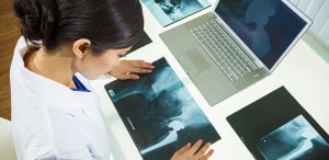 Doctor Examining Hip X-Rays | California Zimmer Kinectiv Lawsuit
