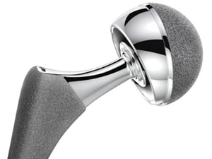 recalled hip replacement